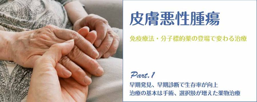 皮膚悪性腫瘍 Part1 早期発見、早期診断で生存率が向上 治療の基本は手術、選択肢が増えた薬物治療の画像