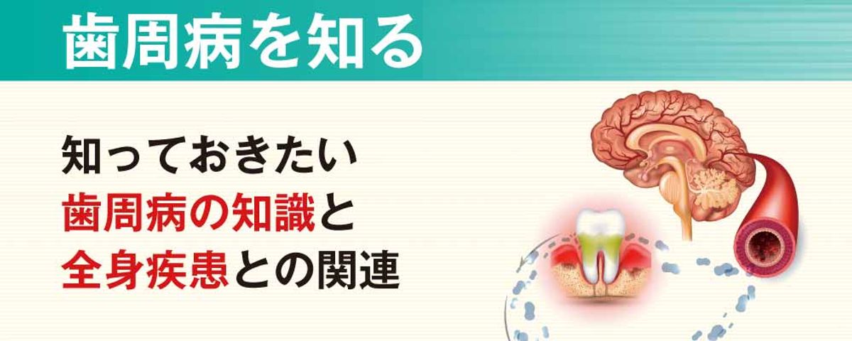 歯周病を知る 知っておきたい歯周病の知識と全身疾患との関連の画像