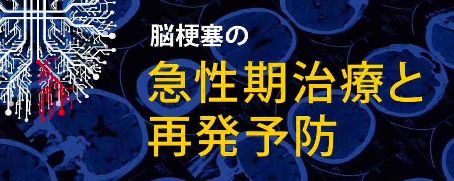 脳梗塞の急性期治療と再発予防画像