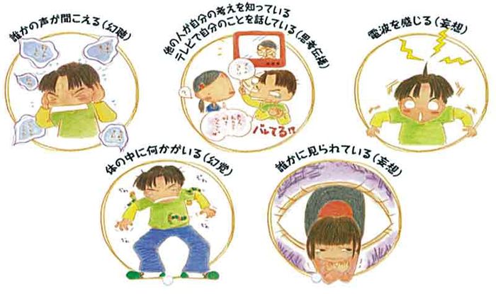 統合失調症とは?の画像
