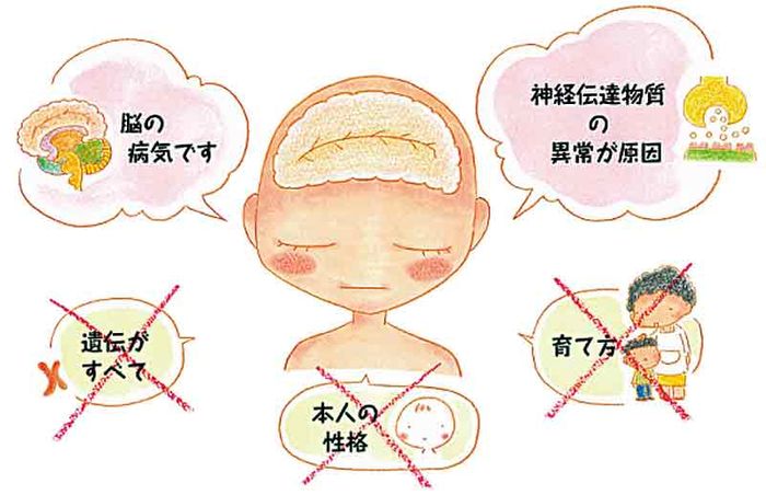 統合失調症とは?の画像