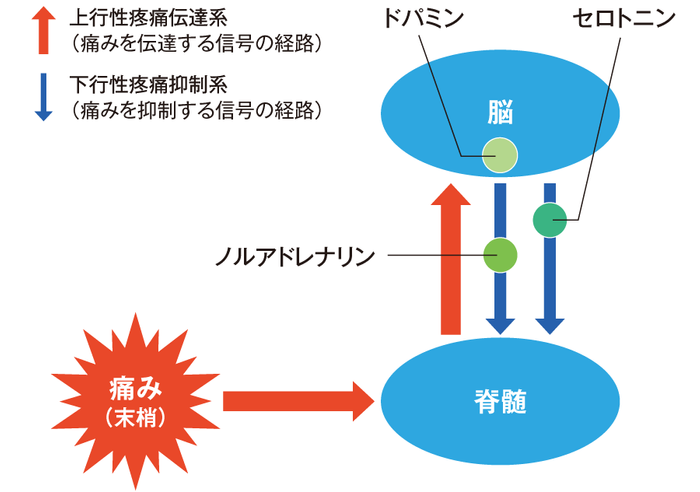 統合失調症とは?の画像