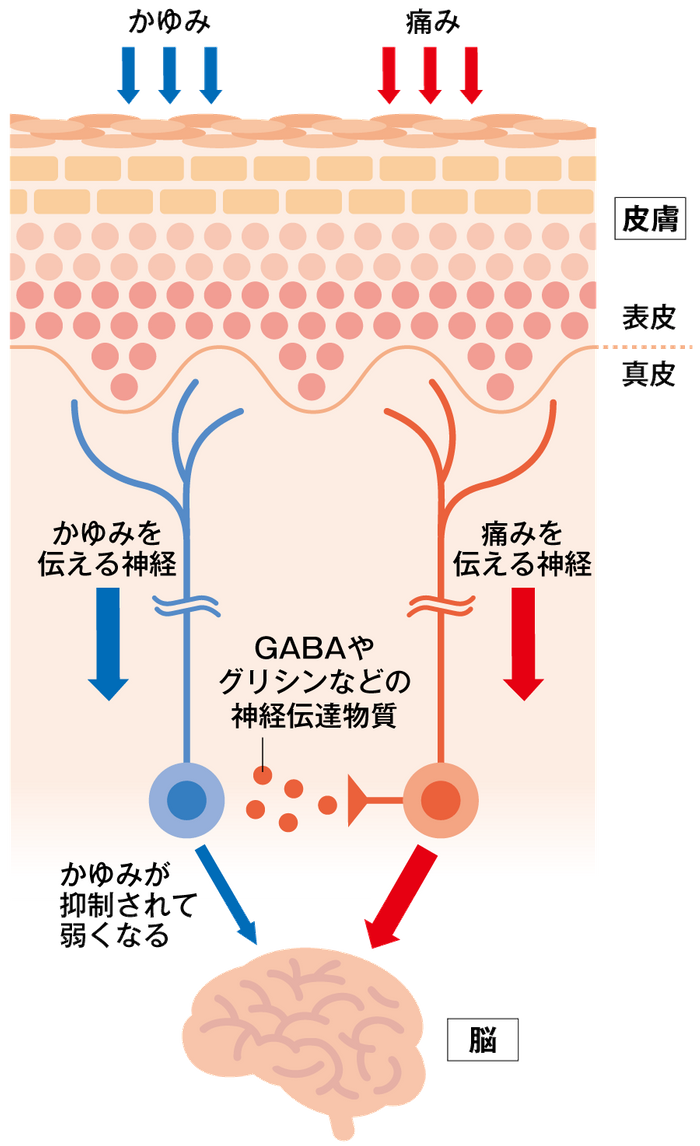 痛みによる鎮痒の仕組みの画像