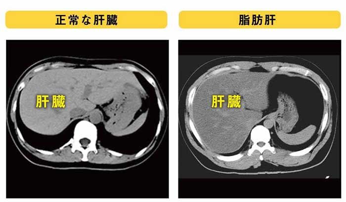 短い答えは何ですか?