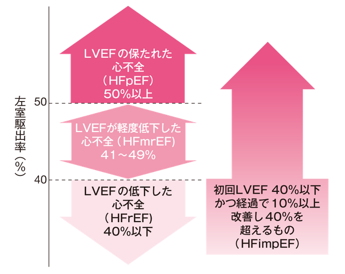 LVEFに基づく心不全分類の画像
