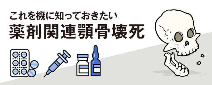 これを機に知っておきたい薬剤関連顎骨壊死の画像