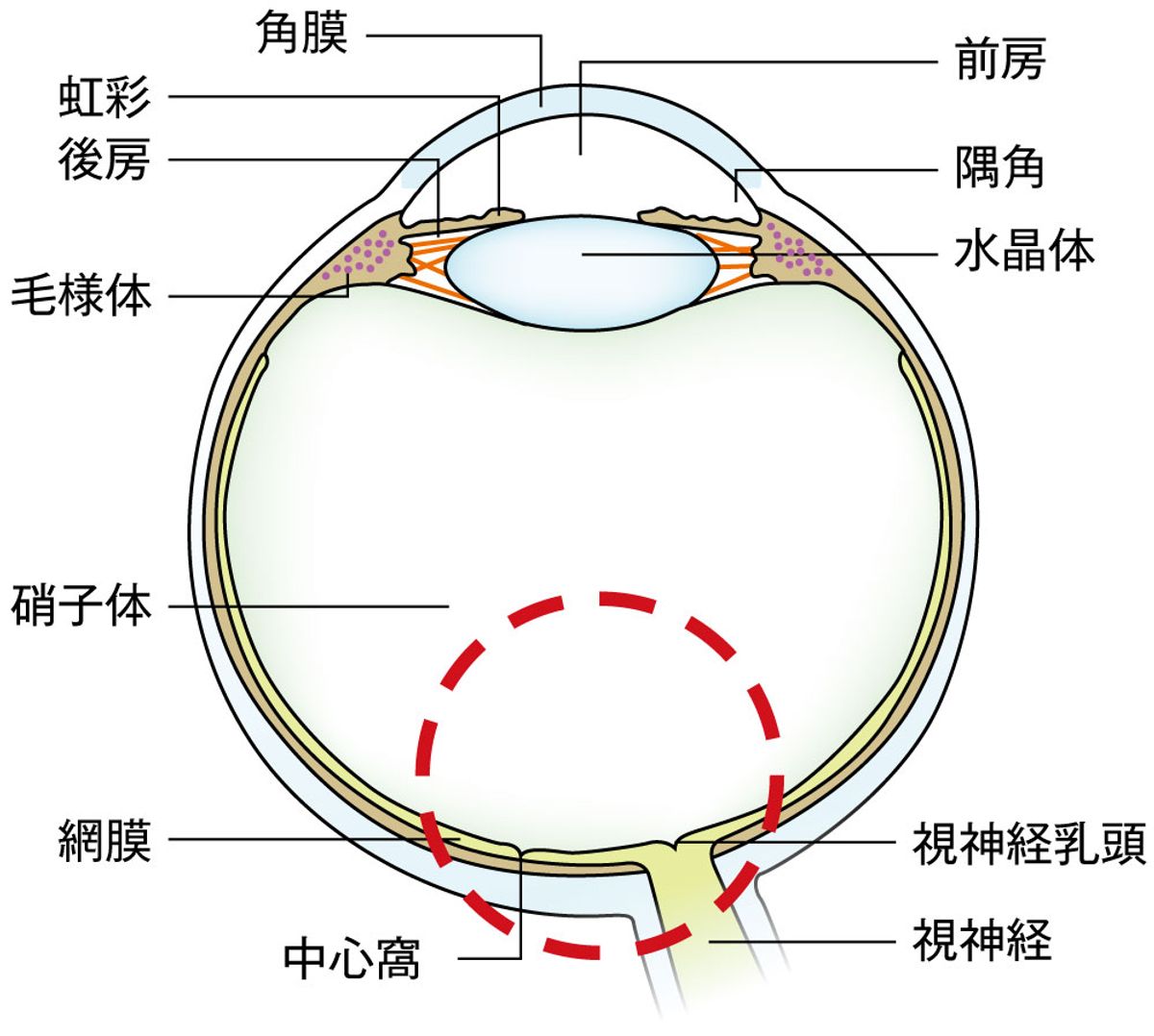 緑内障性視神経変化